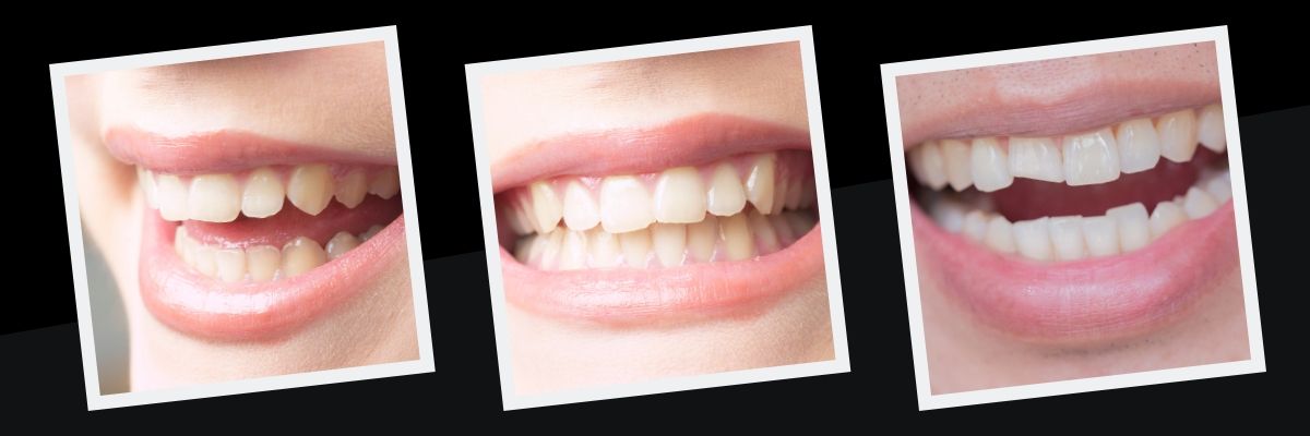 Are You Ready To See How We Can Transform Your Smile?