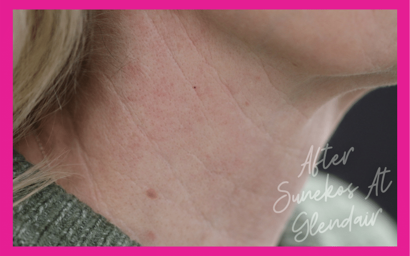 Glendair Dental Sunekos Glendair Dental Sunekos