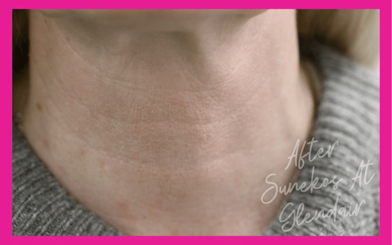 Glendair Dental Sunekos Glendair Dental Sunekos