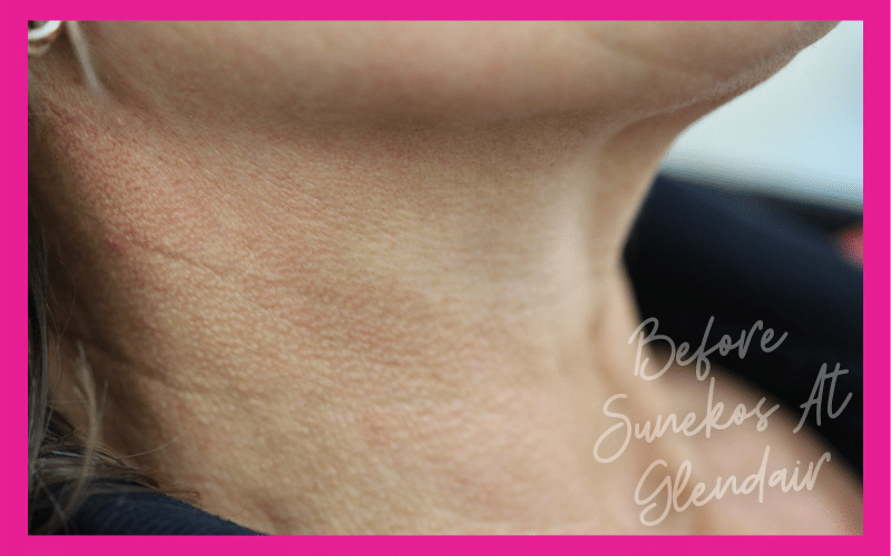 Glendair Dental Sunekos Glendair Dental Sunekos