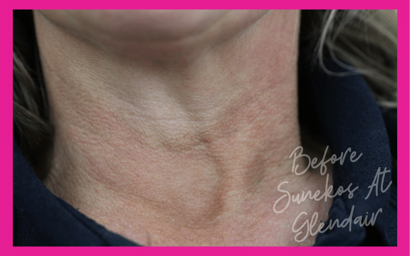Glendair Dental Sunekos Glendair Dental Sunekos