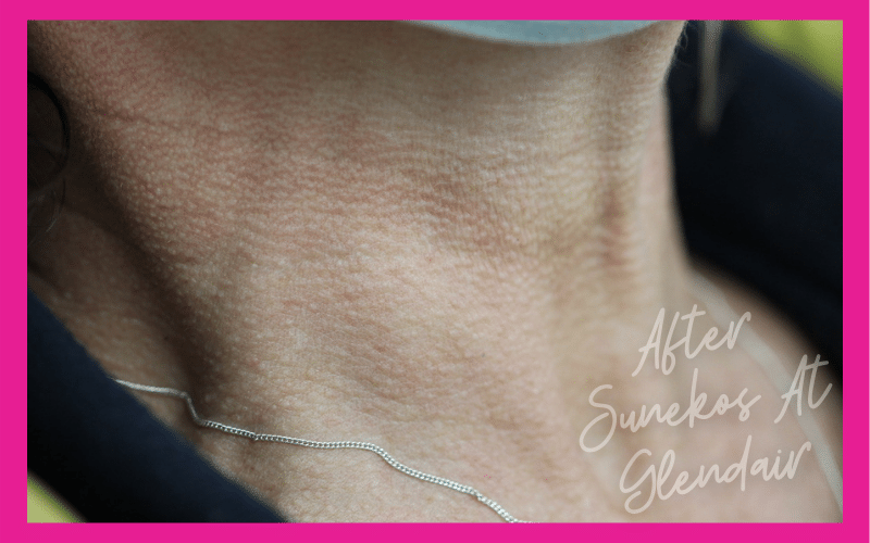 Glendair Dental Sunekos Glendair Dental Sunekos
