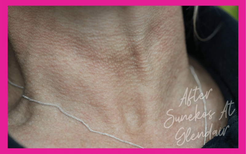 Glendair Dental Sunekos Glendair Dental Sunekos