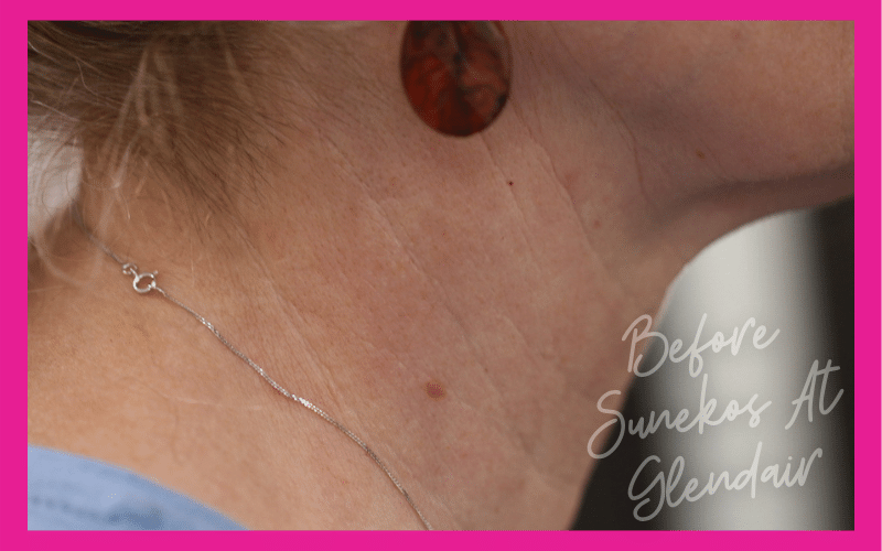 Glendair Dental Sunekos Glendair Dental Sunekos
