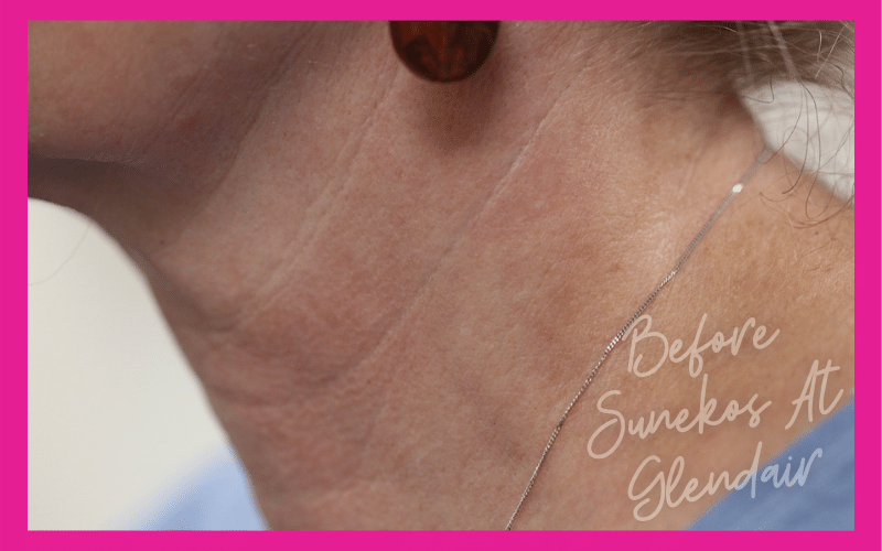 Glendair Dental Sunekos Glendair Dental Sunekos
