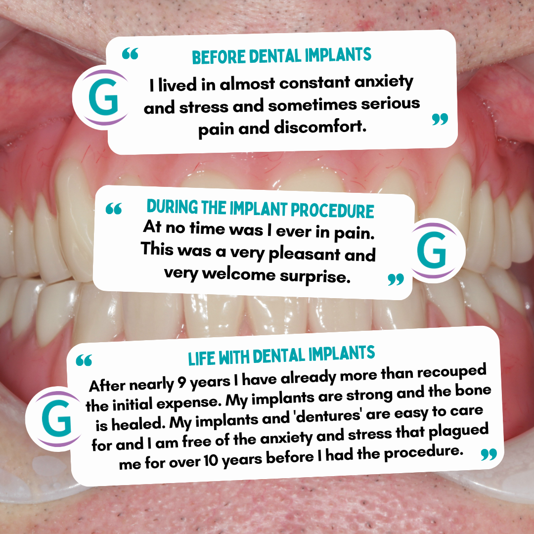 Glendair Dental Dental Implants before and after dental implant treatment Glendair Dental