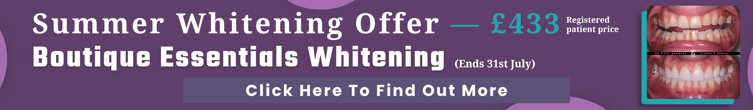 Glendair Whitening Offer